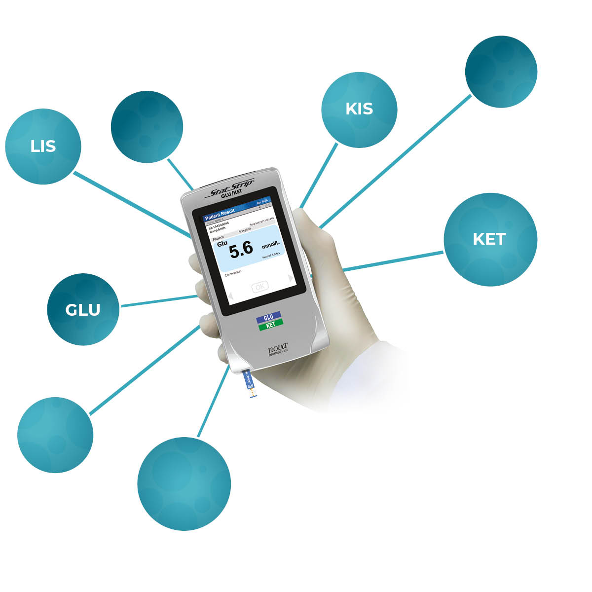 StatStrip® Glucose/Ketones POCT meter // Analytical Systems